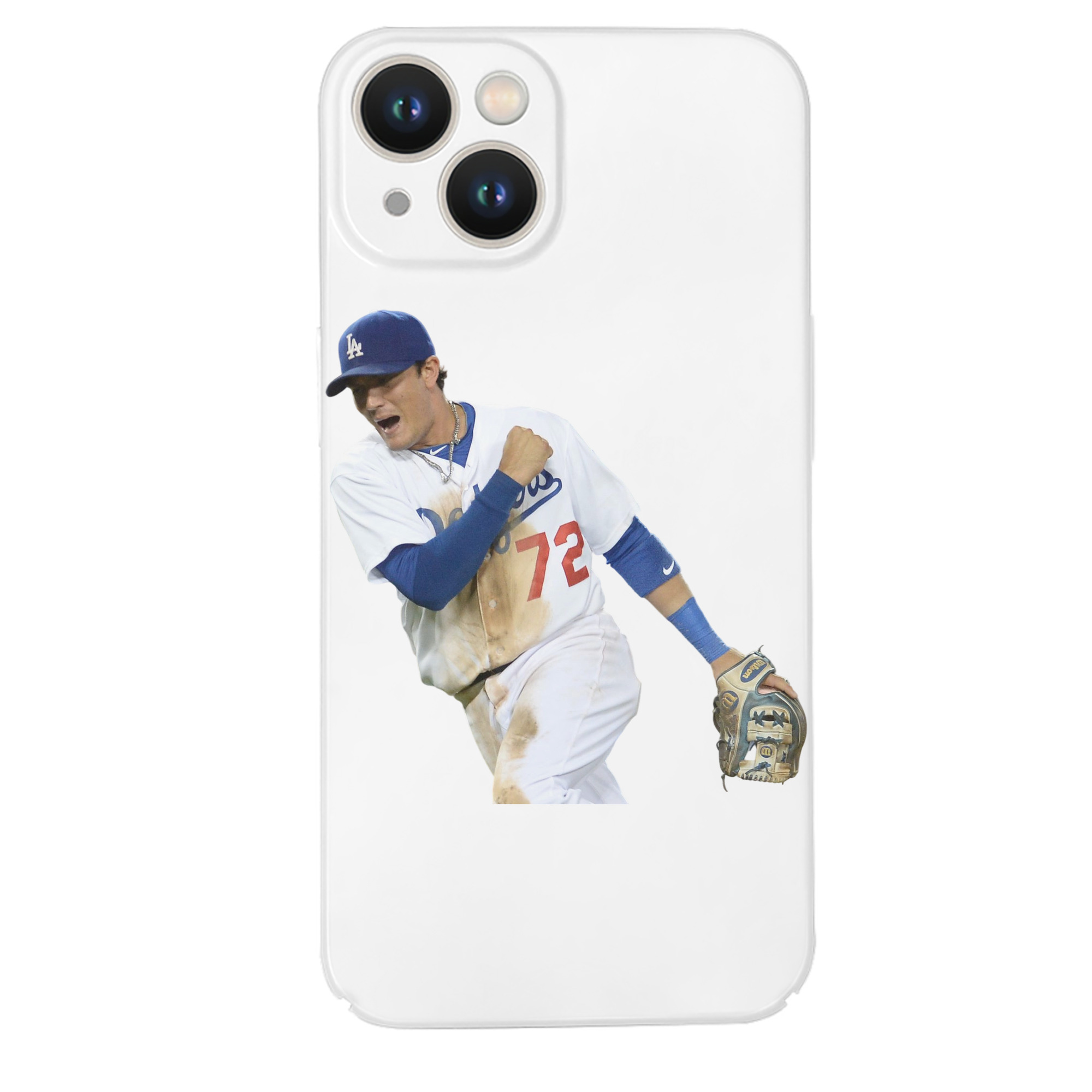  IPhone 14 Series Full-Cover Hard Case – Shockproof With Raised Camera Protection – Precise Cutouts, Wireless Charging Compatible – Durable, Anti-Yellowing, Easy To Clean